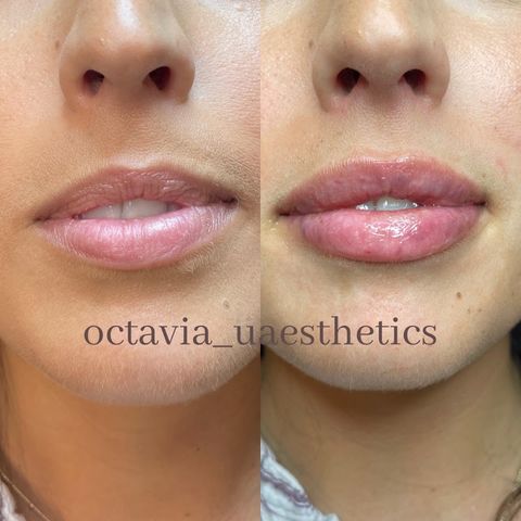 Illustration of OctaviaUAesthetics, spa in Lufkin, TX